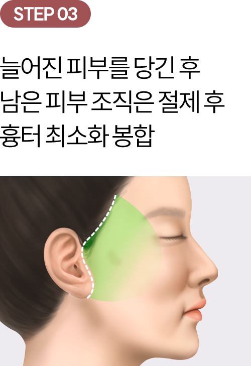 eye_modul_ANga_03-2 eye_modul_ANga_03-2