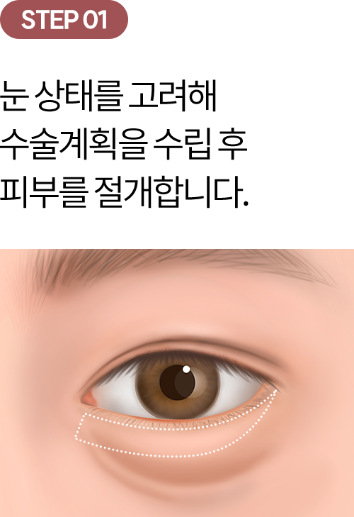 eye_modul_ha_01 eye_modul_ha_01