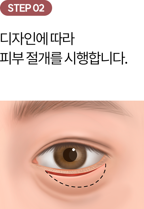 eye_modul_ha_02 eye_modul_ha_02