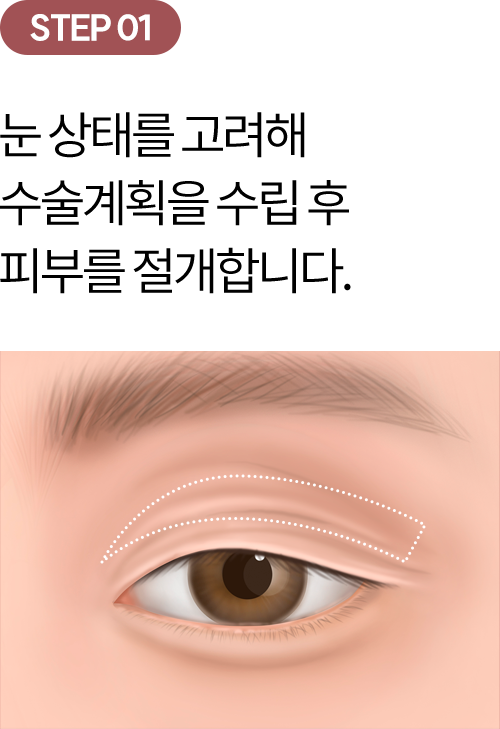 eye_modul_sang_01 eye_modul_sang_01