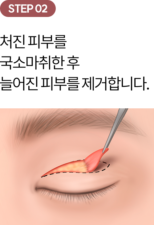 eye_modul_sang_02 eye_modul_sang_02