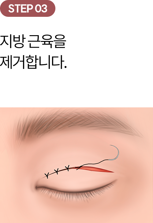eye_modul_sang_03 eye_modul_sang_03