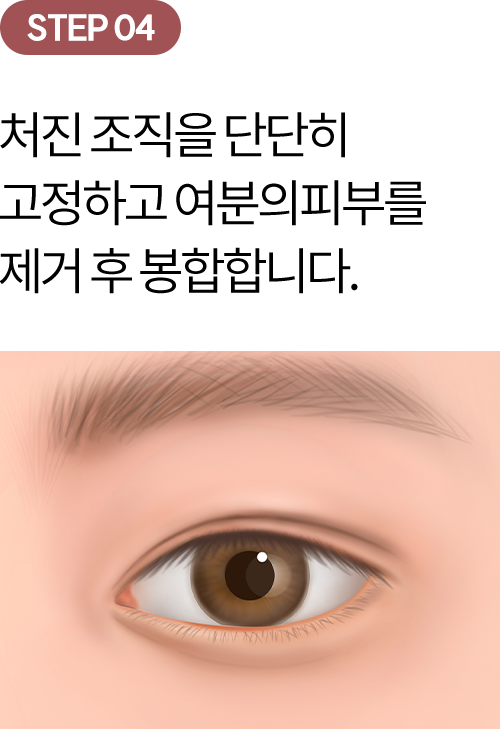 eye_modul_sang_04 eye_modul_sang_04